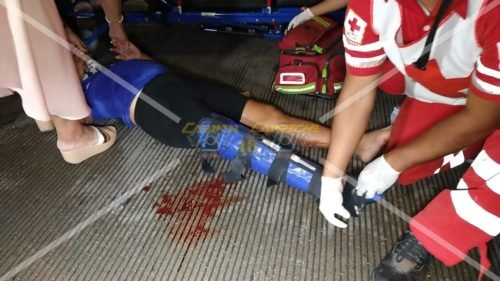 Mujer atropellada, motociclista - Es atropellada y sufre fractura de una pierna. - policiaca